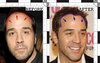 jeremy-piven-hair-transplant-before-and-after.jpg