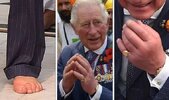 Prince-Charles-health-Swollen-hands-and-feet-condition-laid-bare-Sausage-fingers-1585038.jpg