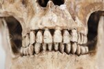 26530599-modelo-de-los-dientes-humanos-cráneo-sobre-un-fondo-blanco.jpg