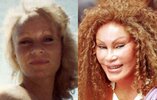 Jocelyn-Wildenstein-before-and-after-plastic-surgery-01.jpg